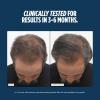 imageNutrafol Men 50 Hair Growth Supplements Clinically Tested for Visibly Thicker Hair and Scalp Coverage 1 DermatologistRecommended Hair Growth Supplement Brand  1 Month Supply 1 Refill Pouch